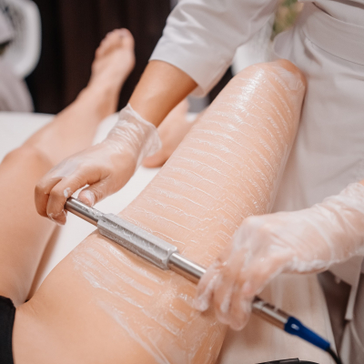 RF лифтинг INDIBA