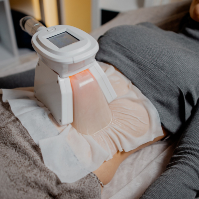 Криолиполиз