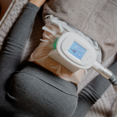 Криолиполиз процедура