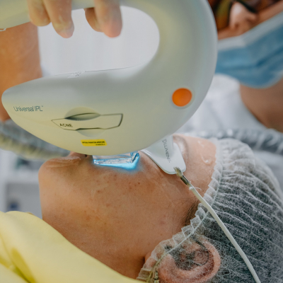 Лечение акне Lumenis M22