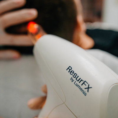 Стимуляция роста волос Lumenis M22