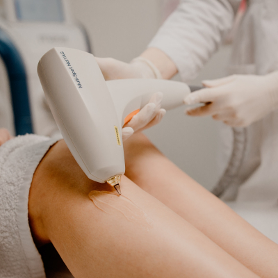 Удаление сосудов на ногах Lumenis M22