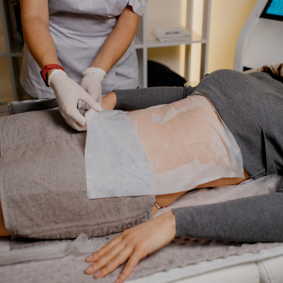 Криолиполиз живота