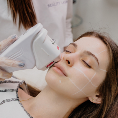 СМАС лифтинг 