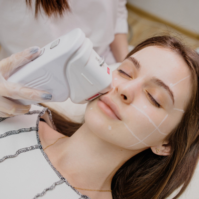 SMAS лифтинг Чернигов