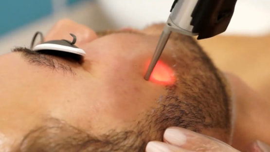 Процедура Эндосфера - аппаратный антицеллюлитный массаж тела: фото описание, плюсы и минусы